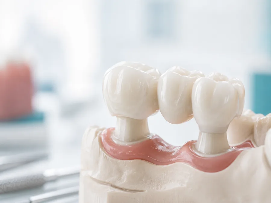 Prótese dentária fixa e removível
